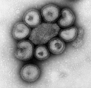 influenza-a-hk-1-68-h3n2-fam-2-greyscale-thumb.jpg.f0f1e3cb0baadb33e5abc9e3925b1343.jpg